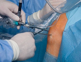 Preventing Surgical Site Infections