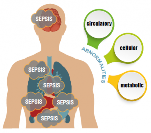 failure-to-diagnose-sepsis