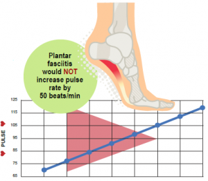 plantar-fasciitis