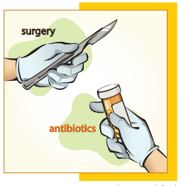 surgery-antibiotics