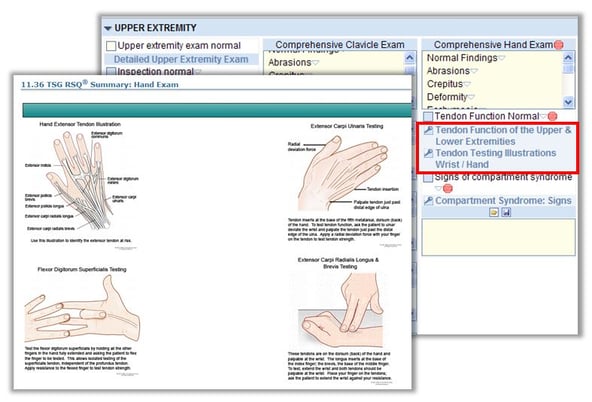 Upper Extremity Injury template - Picis ED Pulsecheck.jpg