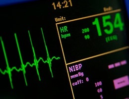 Blog_VeryAbnormalVitalSignsDeathAfterDischarge_MonitorHeartRate_260x200px-3