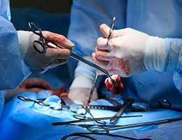 Blog_RetainedSurgicalSponge_SurgerySpongeToolsBlood_260x200dpi